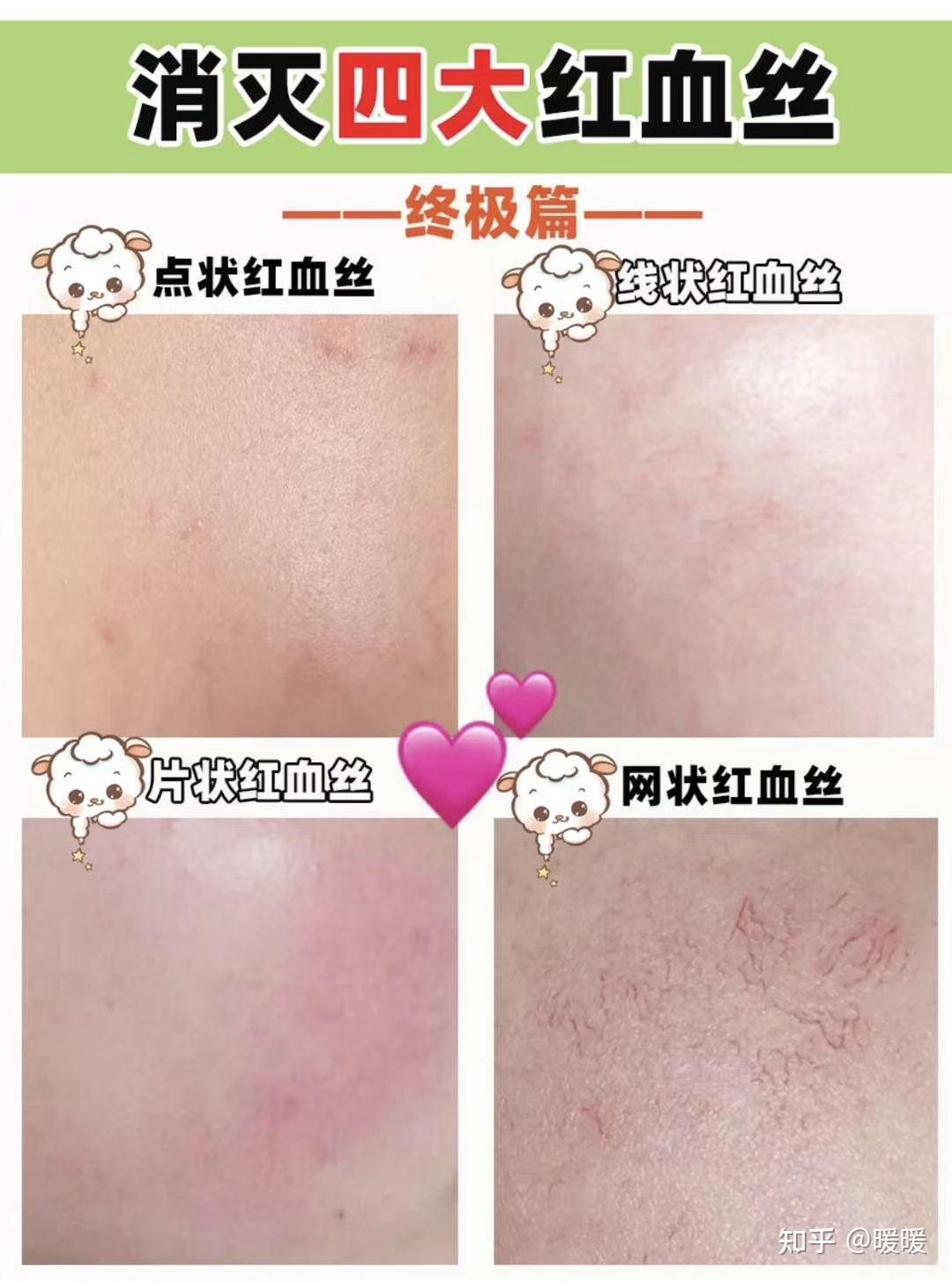 价格暴涨 谁是A股战略金属之王？（附名单）
